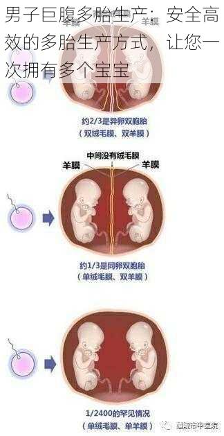 男子巨腹多胎生产：安全高效的多胎生产方式，让您一次拥有多个宝宝